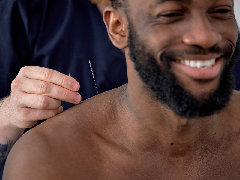 Acupuncture