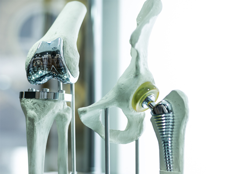 Rehabilitation following fractures, major surgery and joint replacements